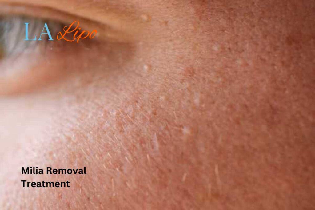 When It’s Time to See a Professional Lutterworth?