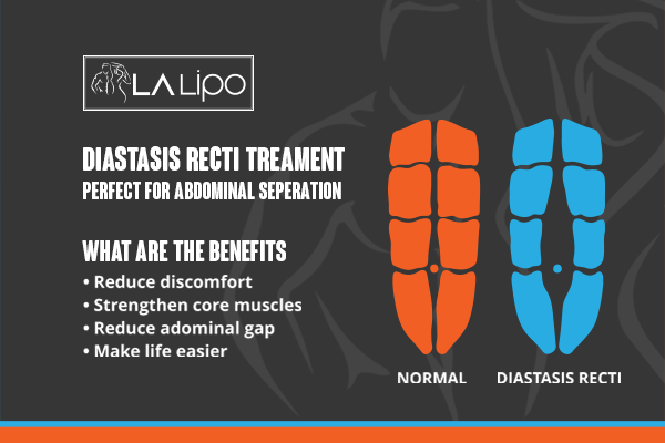 When to Be Concerned About Abdominal Muscle Changes Lutterworth
