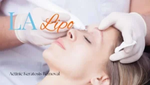 Woman receiving Actinic Keratosis Removal Treatment Lutterworth