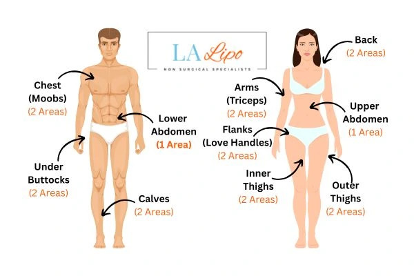 LA LIPO Cryolipolysis Areas Lutterworth