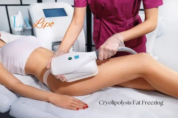 Woman receiving coolsculpting Lutterworth treatment on her thighs