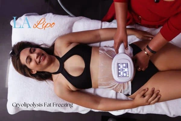 woman getting cryolipolysis Lutterworth