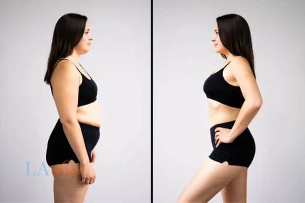 Picture of womans before and after using LA-EMS body sculpting to improve her core strength Lutterworth
