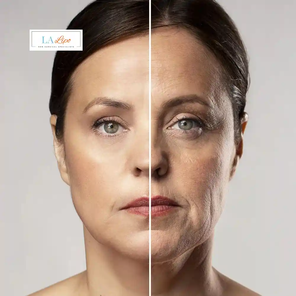 How Can You Tell If Non-Surgical Skin Tightening Is Right for You Lutterworth?