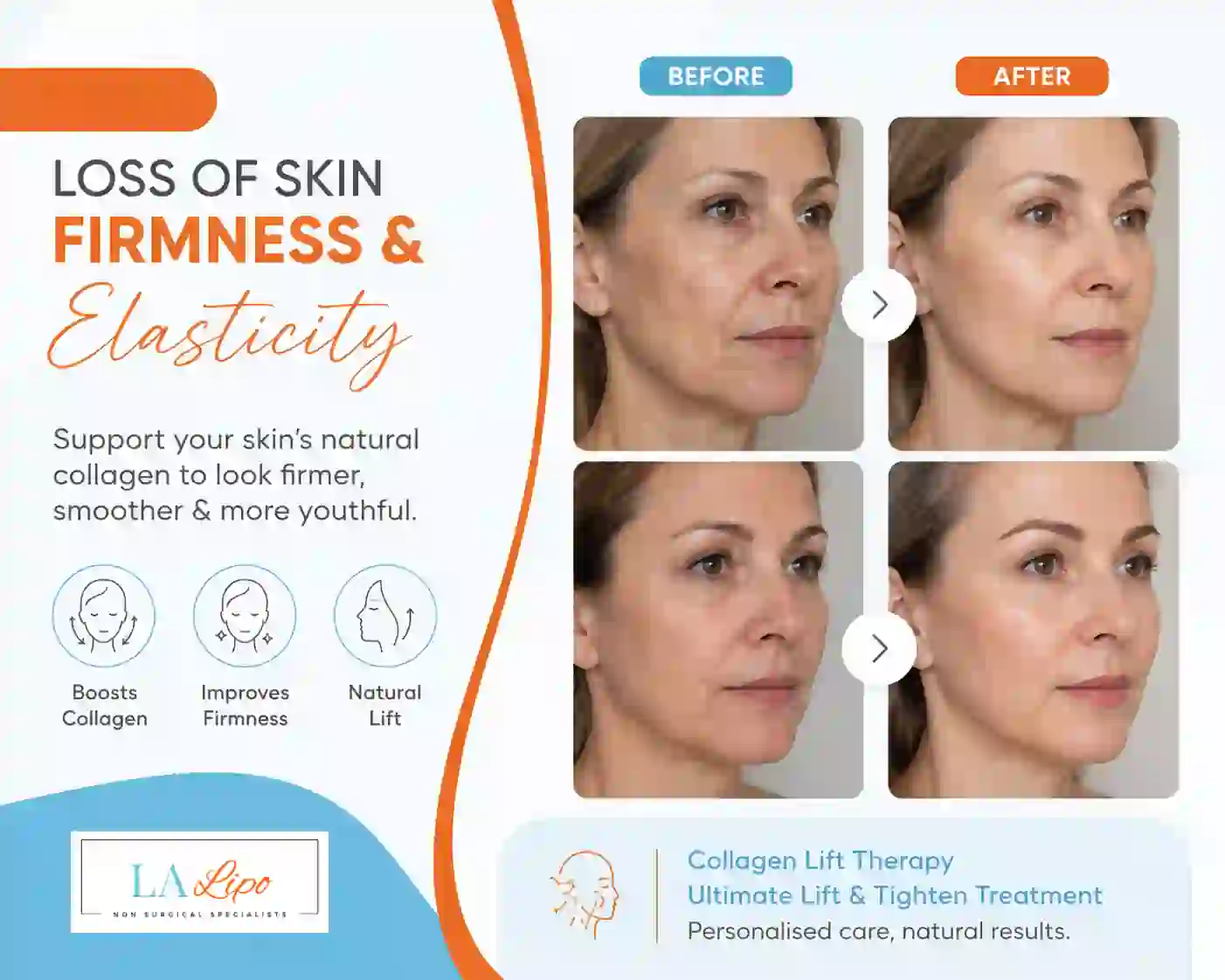 Sign #7: Loss of Skin Firmness and Elasticity Lutterworth